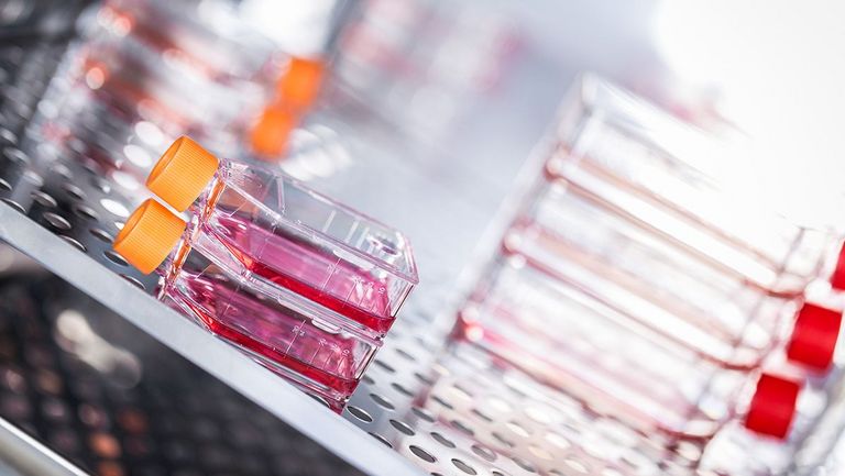 Flüssigkeiten in Petrischalen 